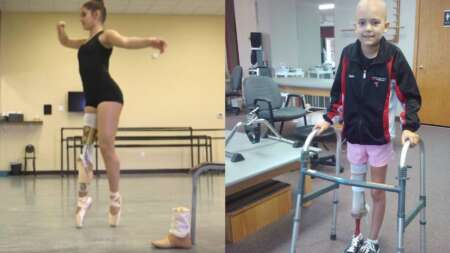 μπαλαρίνα-που-έχασε-το-πόδι-της-από-καρ-65099