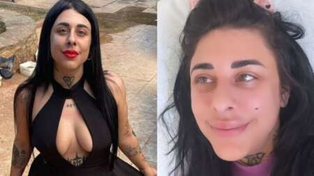 μου-βγάλαν-περίπου-2-λίτρα-λίπος-η-super-κ-74361