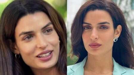 παραμορφώθηκε-το-πρόσωπό-της-η-τόνια-σ-83440