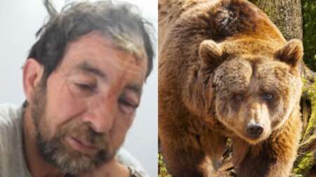 συγκλονίζει-ο-βοσκός-που-δέχτηκε-επίθ-87737