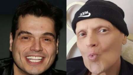 πως-θα-τραγουδήσεις-έτσι-χωρίς-μαλλι-107931