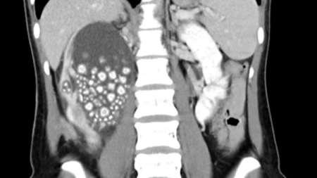 έμειναν-άφωνοι-οι-γιατροί-δεν-έπι-105703