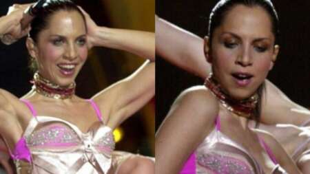 59-ετών-παραμορφωμένη-από-τις-πλαστικές-118949