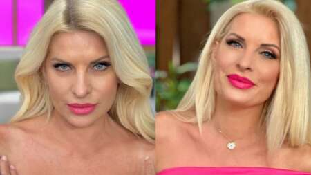 ούτε-πλαστική-ούτε-μπότοξ-αυτό-κάνει-σ-117091