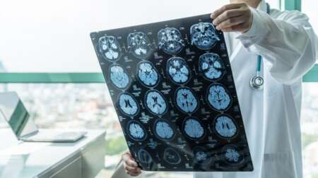 ανατροπή-δεν-είναι-ο-καρκίνος-αυτή-είν-127392