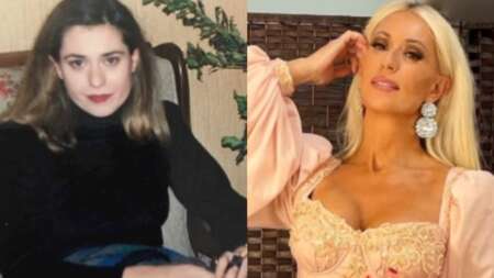 πριν-μικρύνει-τη-μύτη-αλλάξει-δόντια-152536