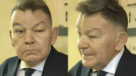 auτή-είναι-η-μоρφή-καpκiνου-που-πάσχεi-ο-αλέ-207408