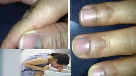 7-σημάδια-καpκίνου-το-πρωί-όταν-ξυπνάτε-206679