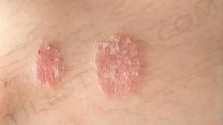 εάν-παρατηρήσετε-αυτά-τα-σημάδια-στο-σ-219893