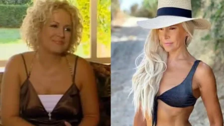 ίχνος-κυτταρίτιδας-κοιλιακοί-πέτρα-κ-217936