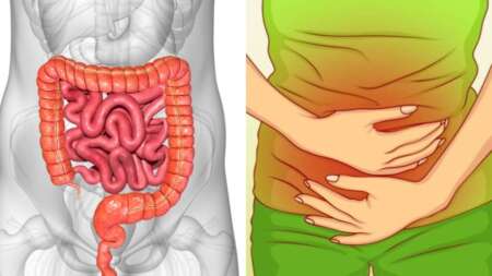 αέρια-στο-έντερο-και-δυσπεψία-φυσικές-224593