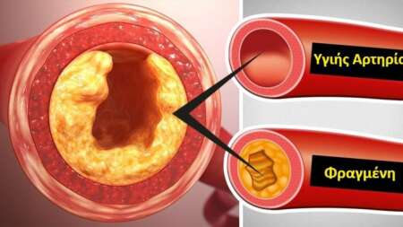 χοληστερόλη-το-κατακόκκινο-φρούτο-πο-222155