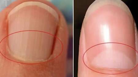 τι-πραγματικά-είναι-το-ημισέληνο-στη-β-220140