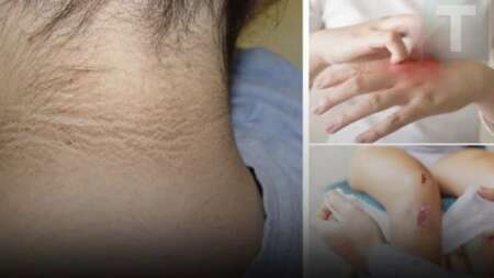 όταν-το-σώμα-έχει-τα-5-αuτά-συμπτώματα-μπ-224208