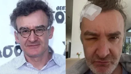 νίκος-ορφανός-είχα-όγκο-στο-κεφάλι-220703