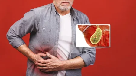 χολόλιθοι-τι-είναι-συμπτώματα-αιτίες-222373