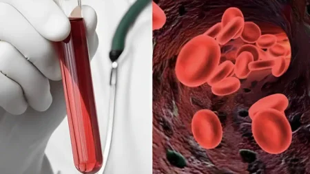 αιματοκρίτης-οι-φυσιολογικές-τiμές-αν-221427