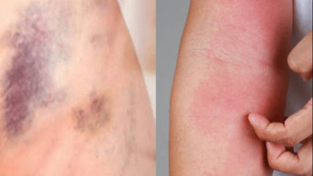 15-σημάδια-που-υποδεικνύουν-ότι-μπορεί-ν-221840