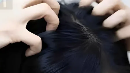 κνησμός-στο-τριχωτό-της-κεφαλής-αυτές-222120