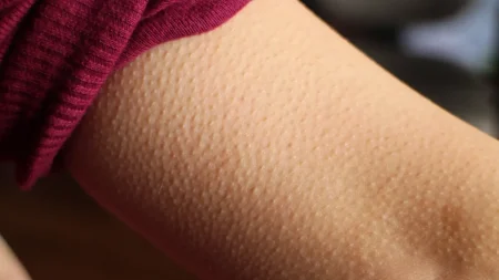 αν-έχετε-ανατριχίλα-χωρίς-λόγο-είναι-έ-228369