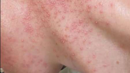 αυτές-είναι-οι-συνέπειες-του-φαγητού-232890