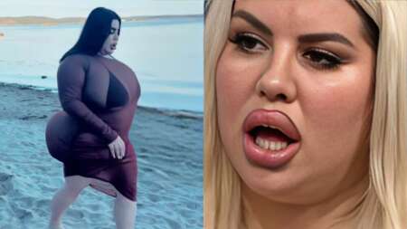 ξόδεψα-150-000-σε-πλαστικές-επεμβάσεις-αλλ-236935