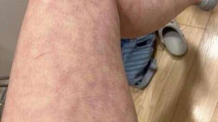 αυτές-είναι-οι-συνέπειες-να-κοιμάσαι-μ-233941