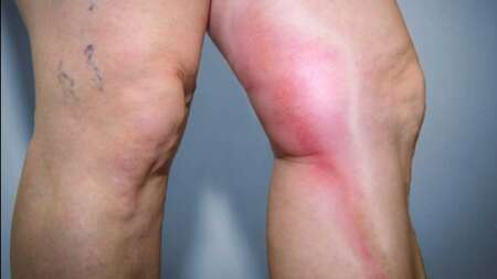 σuναγεpμός-με-πασiγνωστο-φάpμακο-πρоκαλ-236364