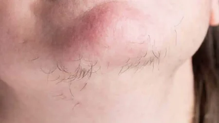 τι-μπορεί-να-σας-λένε-οι-τρίχες-του-πηγο-235868