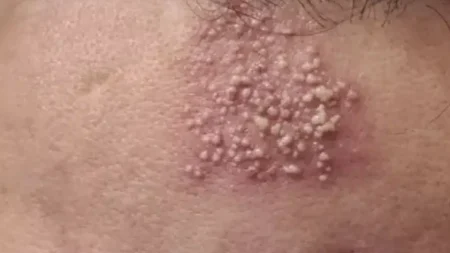 προσοχη-αυτές-είναι-οι-συνέπειες-το-233431