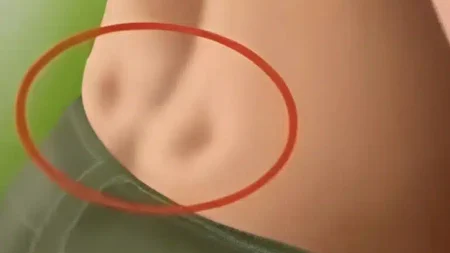 έχετε-δύο-λακκάκια-στο-κάτω-μέρος-της-π-234023