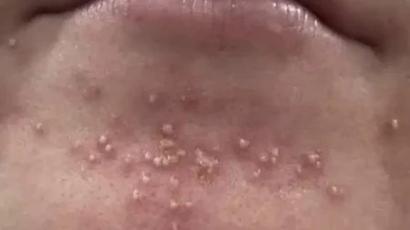 αυτές-είναι-οι-συνέπειες-του-να-κοιμάσ-234509