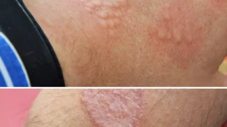 πώς-να-μειώσετε-τον-ερεθισμό-του-δέρμα-233191